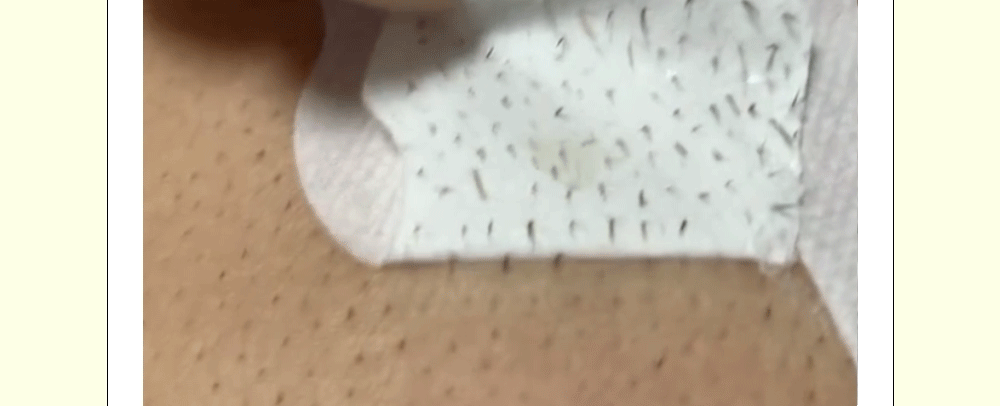 HATHERINE 毛孔清洁 茶树 鼻贴 面膜8片 source detail 13