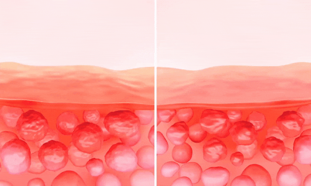 rdrd 绿苹果 乳酸 平衡 泡泡爽肤水 95g source detail 18