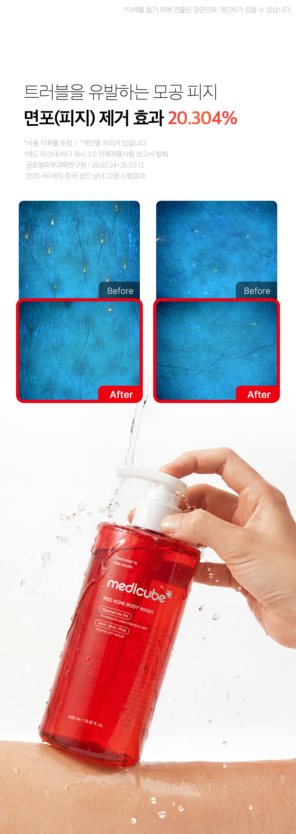 Medicube Red Acne Body Wash 3.0 商品說明圖 9