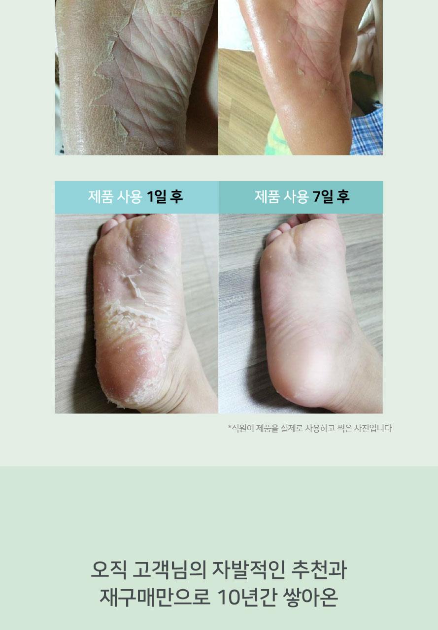 Sopris 足部去角质 双支装 精华液 面膜 Oe 1Jong source detail 8