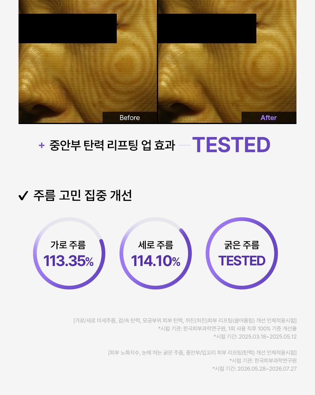 메디힐 PDRN 네모패드 묶음 상세 3