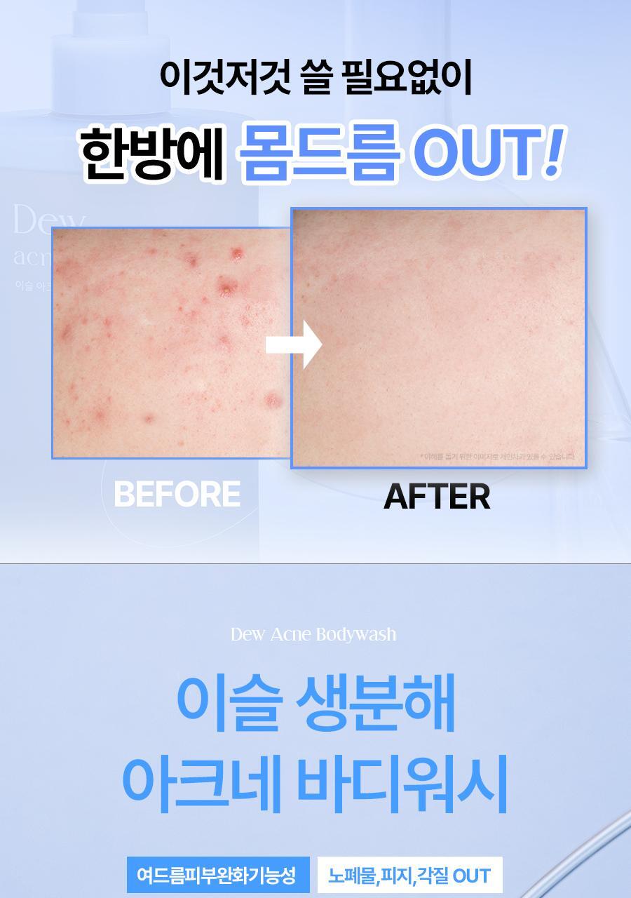 SEEDBEE Isulo Biodegradable Acne Body Wash 500ml