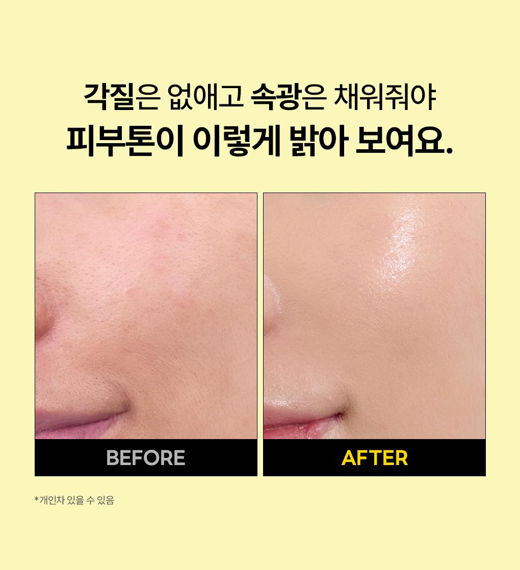 Mediheal 维生素C焕亮精华 40ml source detail 3