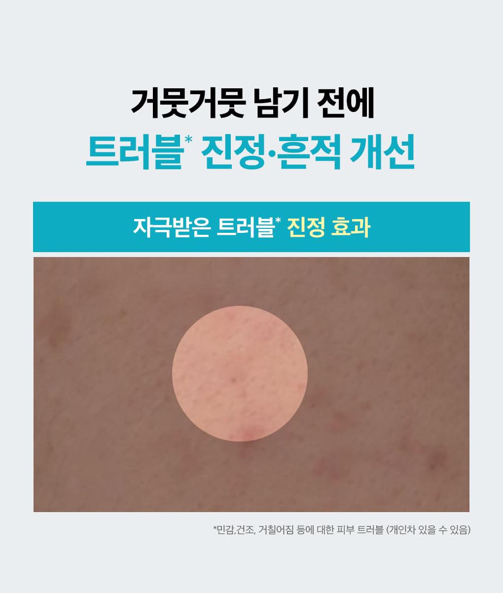 [1Deung/单品] Mediheal 积雪草苷 痕迹修复精华 40ml source detail 18
