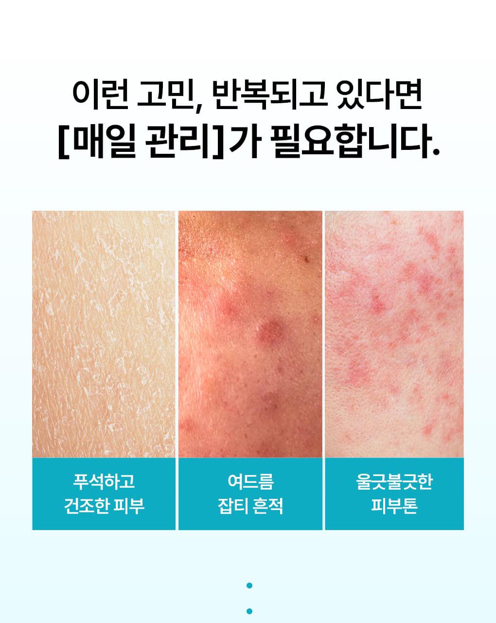 [1Deung/单品] Mediheal 积雪草苷 痕迹修复精华 40ml source detail 7