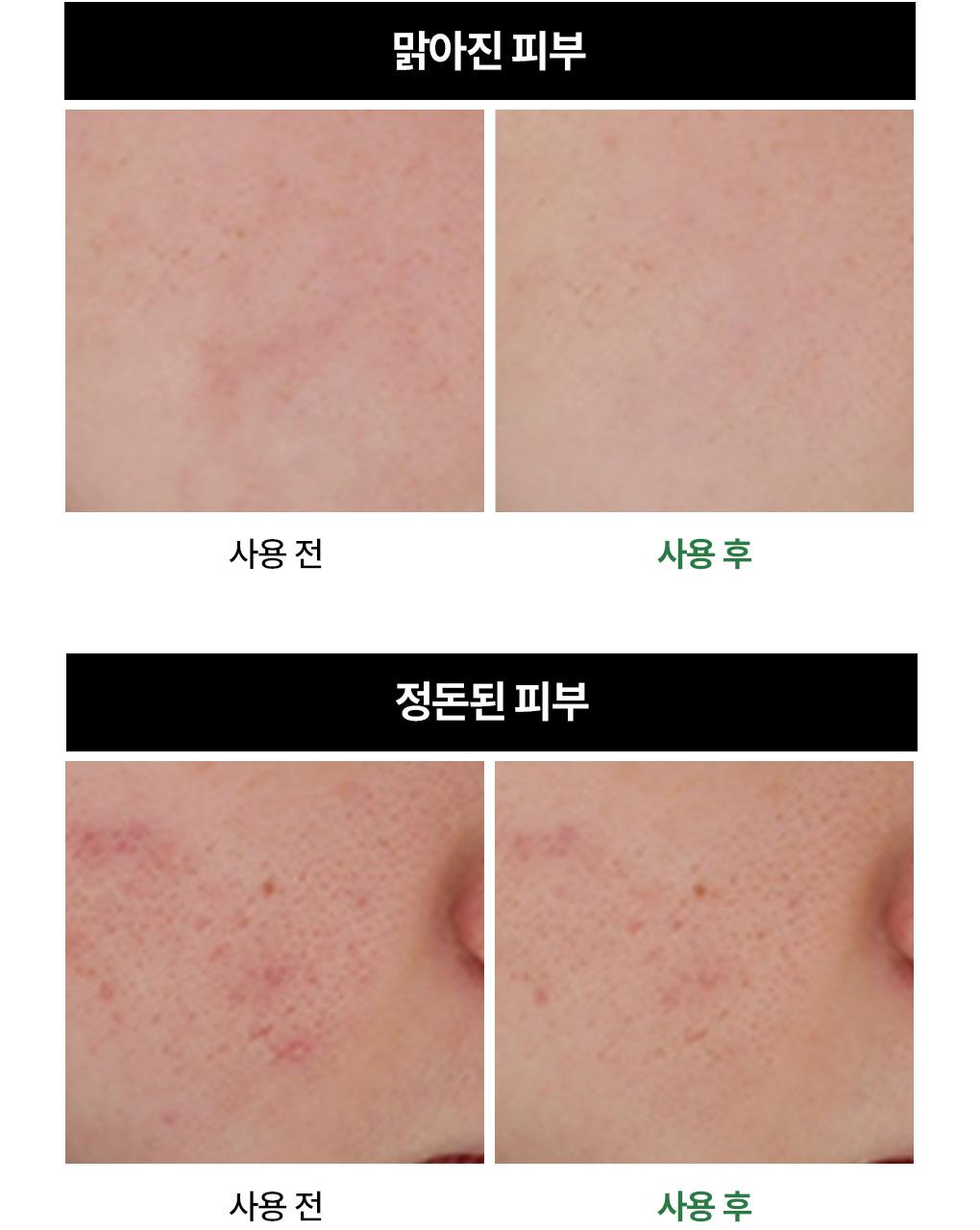 Mediheal 茶树舒缓补水精华 40ml source detail 3