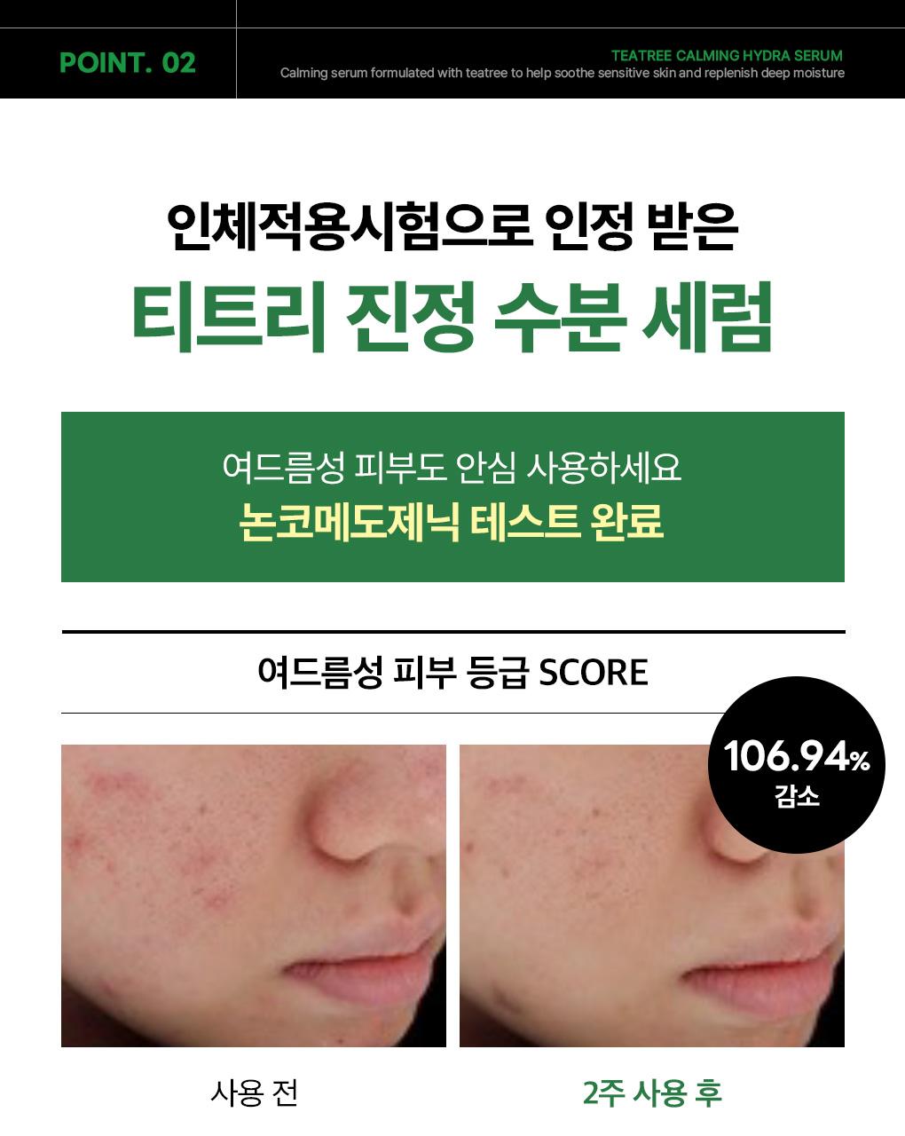 Mediheal 茶树舒缓补水精华 40ml source detail 10