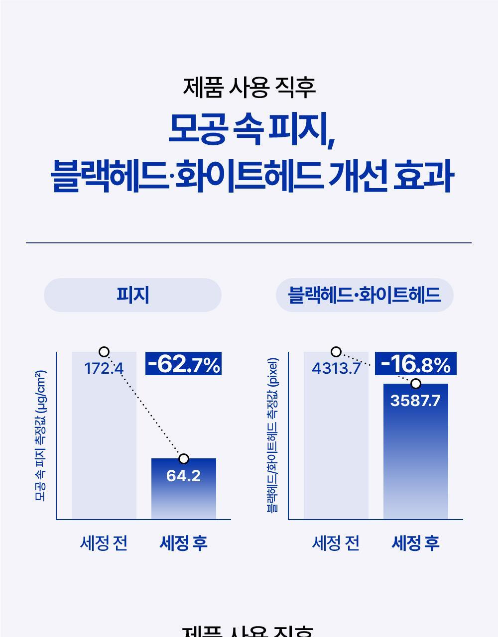 제품 사용 직후 모공 속 피지 블랙헤드 화이트헤드 개선 효과