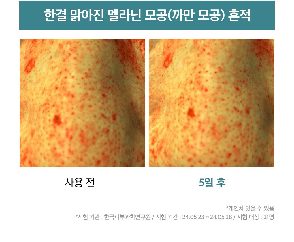 Mediheal 积雪草苷 毛孔 修复 Spicule 精华 40ml source detail 13