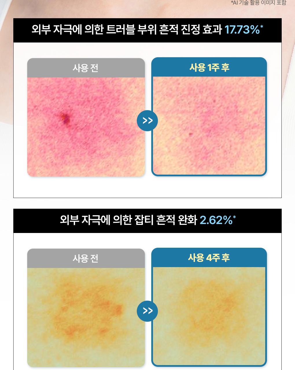 [凝胶面膜/4片] Mediheal Haipeo 面膜 4Jong (胶原蛋白/PDRN/玻尿酸/积雪草苷) source detail 39