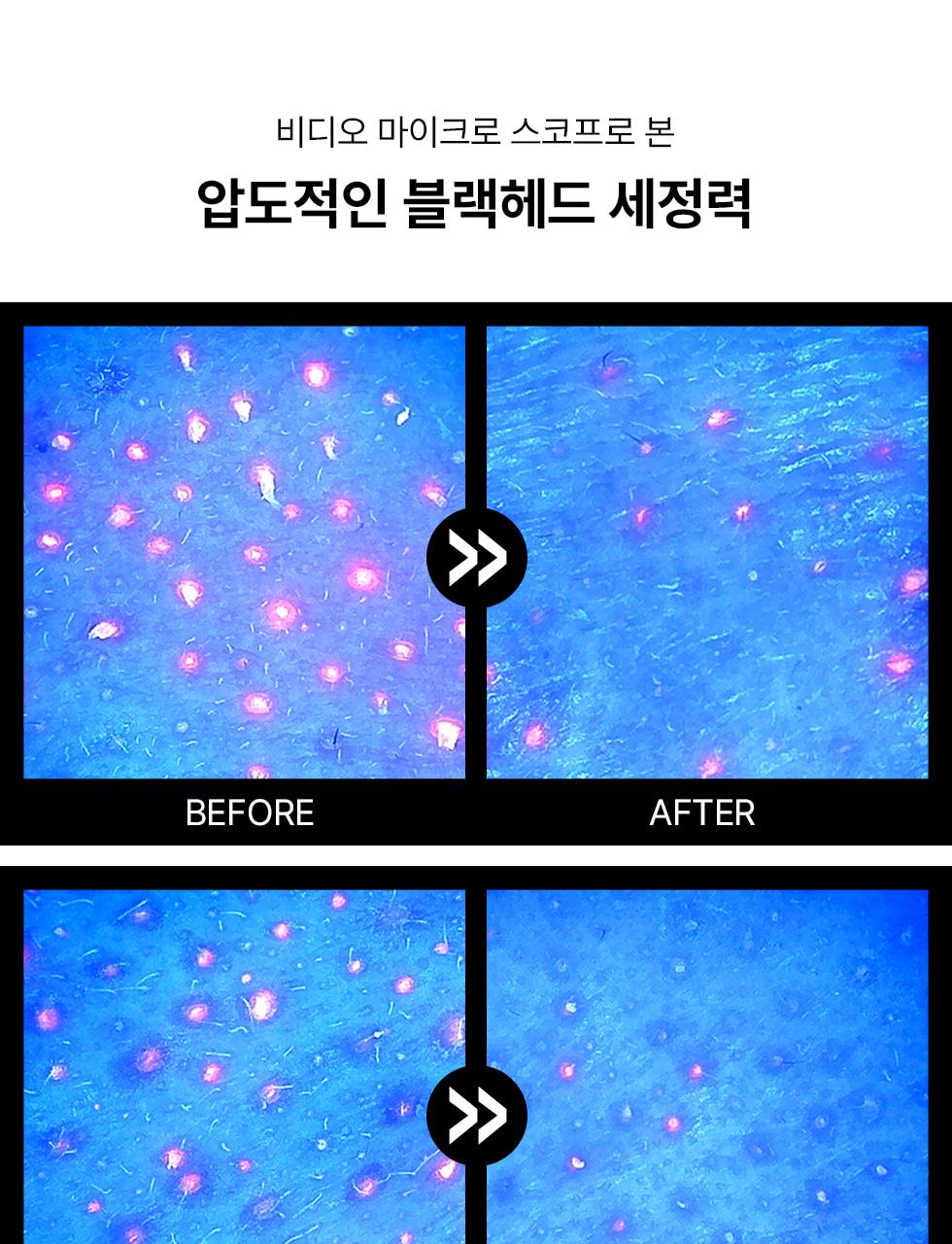[Meoraengsop/Paek刷子] 爽肤水Sigeuneol 粘土酵素洁面乳 面膜70g 赠洁面刷企划装 (粉色/Green Giant) source detail 25