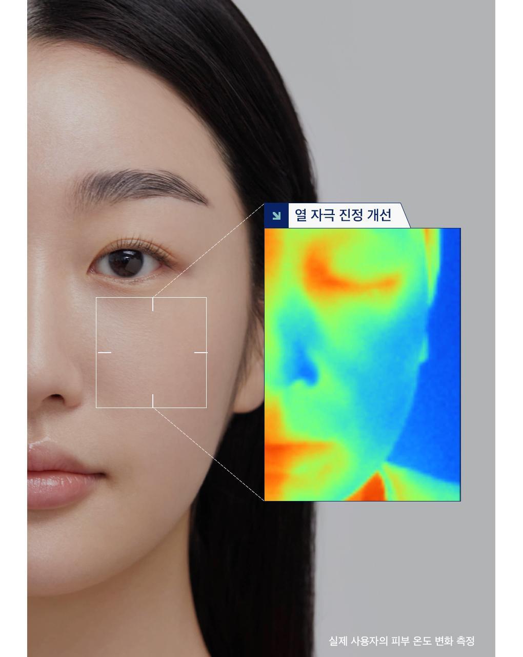 네모패드 마데카소사이드 18