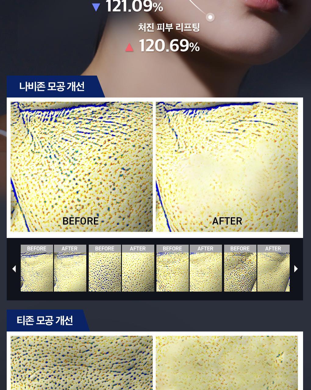 Mediheal Nemo Pad PDRN 3