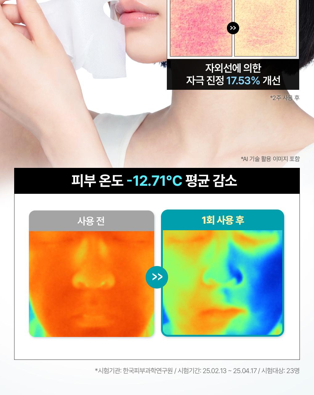 [吸附皮脂/毛孔清凉] Mediheal 生物第二代面膜 1片 3Jong (积雪草苷/PDRN/玻尿酸) source detail 9