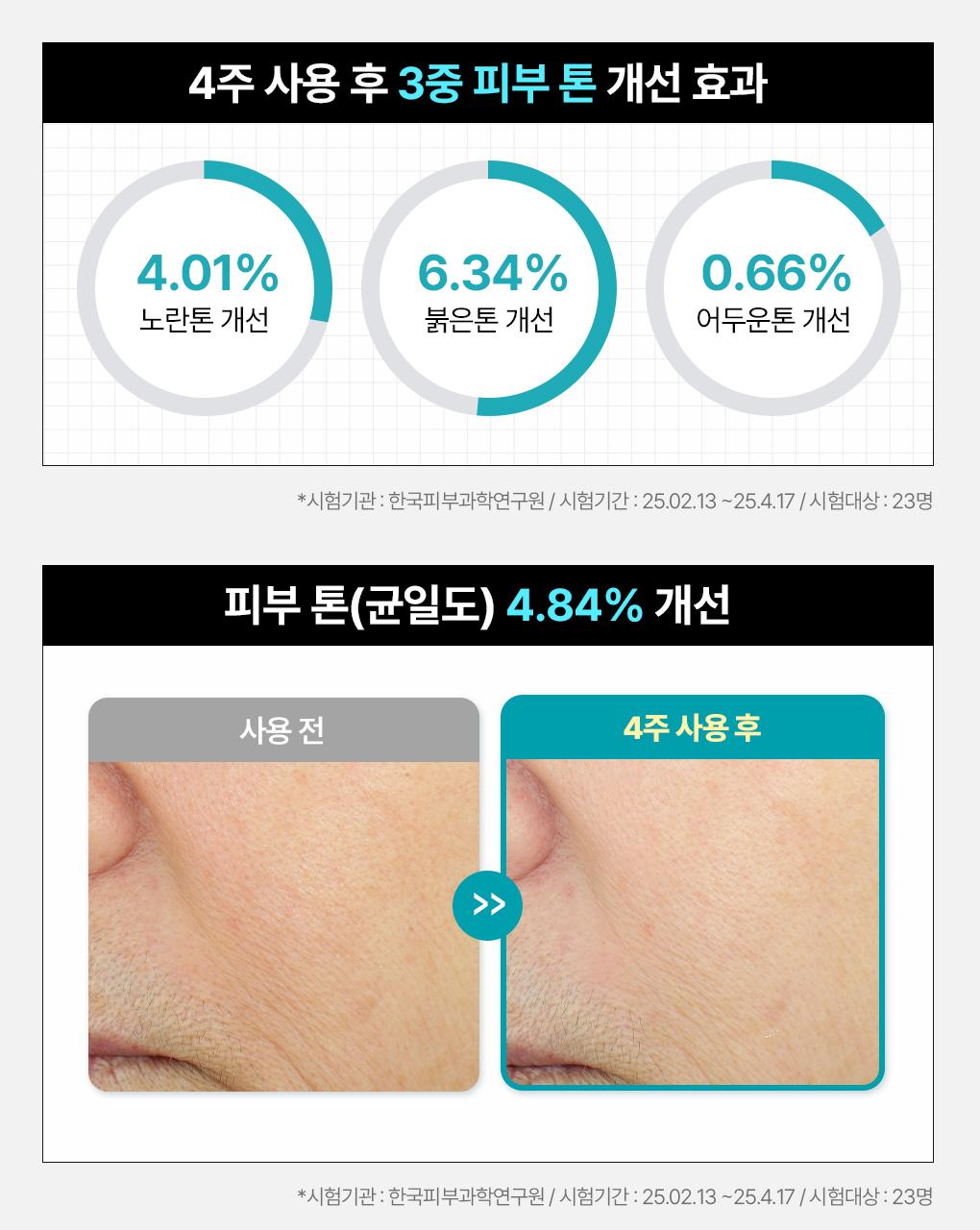 [吸附皮脂/毛孔清凉] Mediheal 生物第二代面膜 1片 3Jong (积雪草苷/PDRN/玻尿酸) source detail 12
