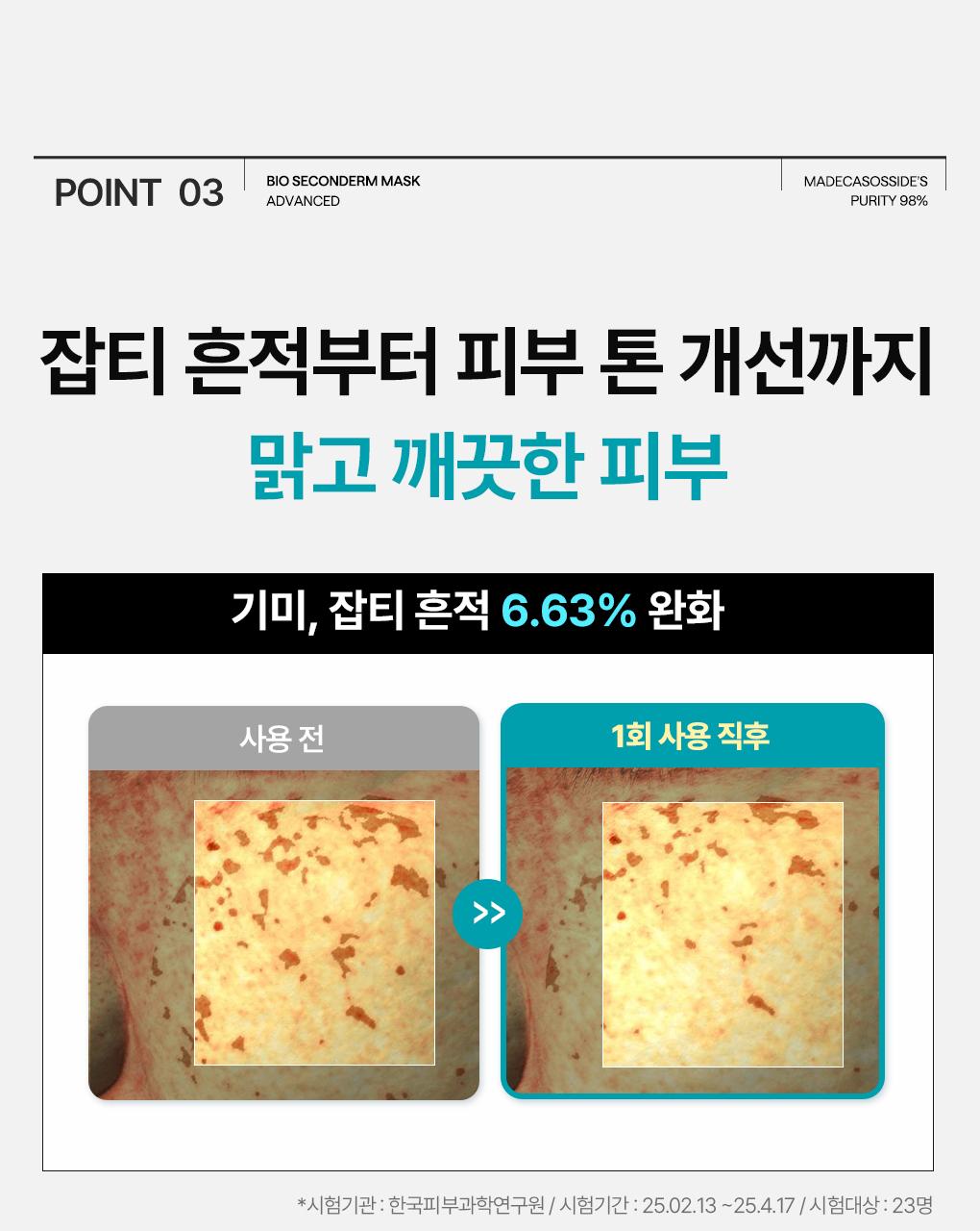 [吸附皮脂/10片] Mediheal 生物第二代面膜 3Jong (积雪草苷/PDRN/玻尿酸) source detail 11