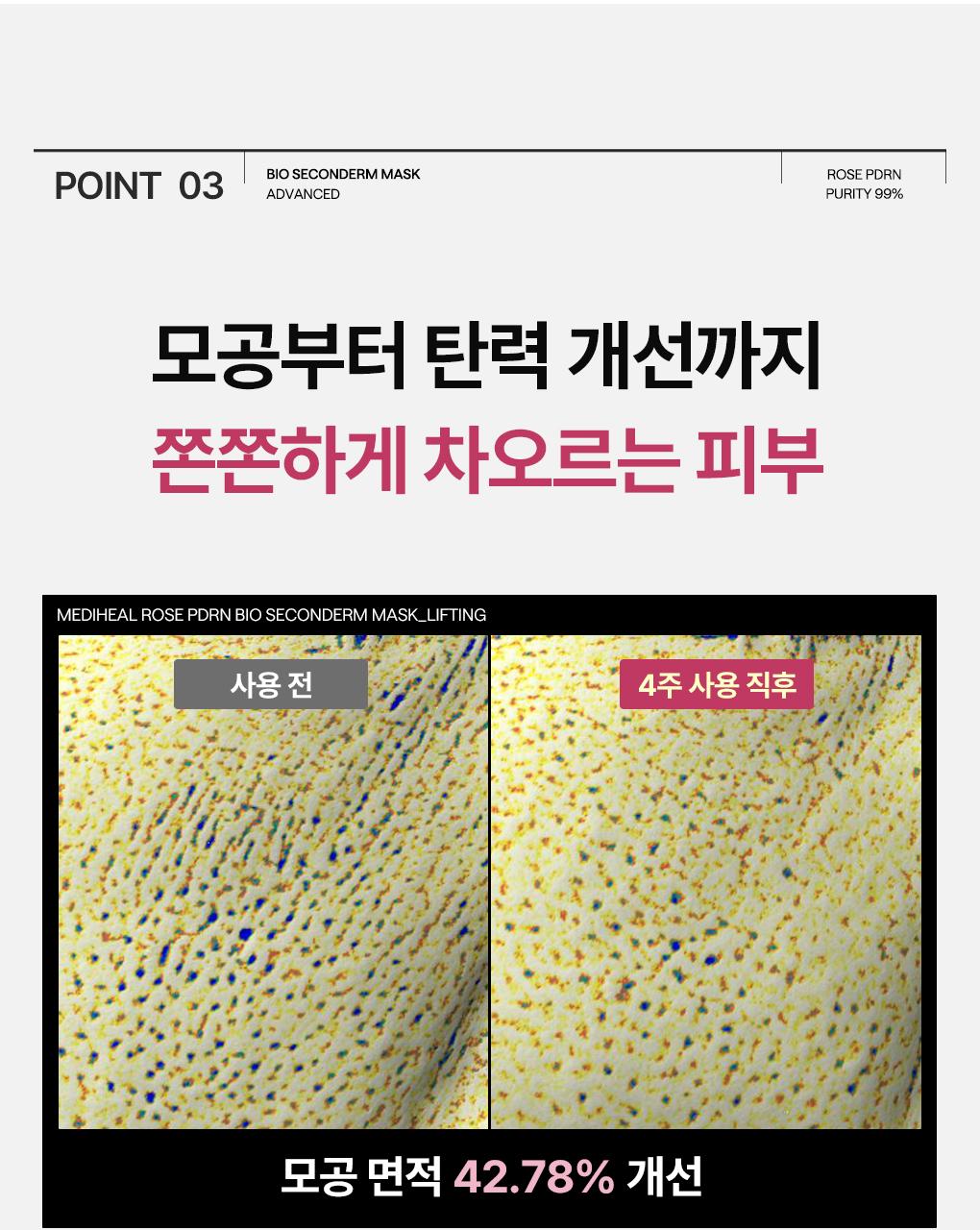 [吸附皮脂/10片] Mediheal 生物第二代面膜 3Jong (积雪草苷/PDRN/玻尿酸) source detail 33