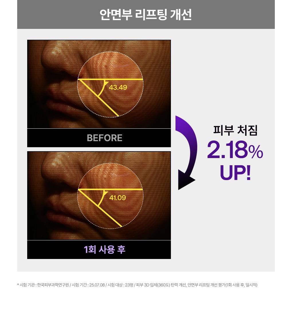 [紧贴精华面膜] Mediheal 包装精华面膜 1片 6Jong source detail 31