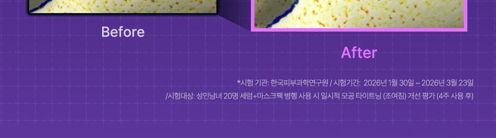 [紧贴精华面膜] Mediheal 包装精华面膜 1片 6Jong source detail 22