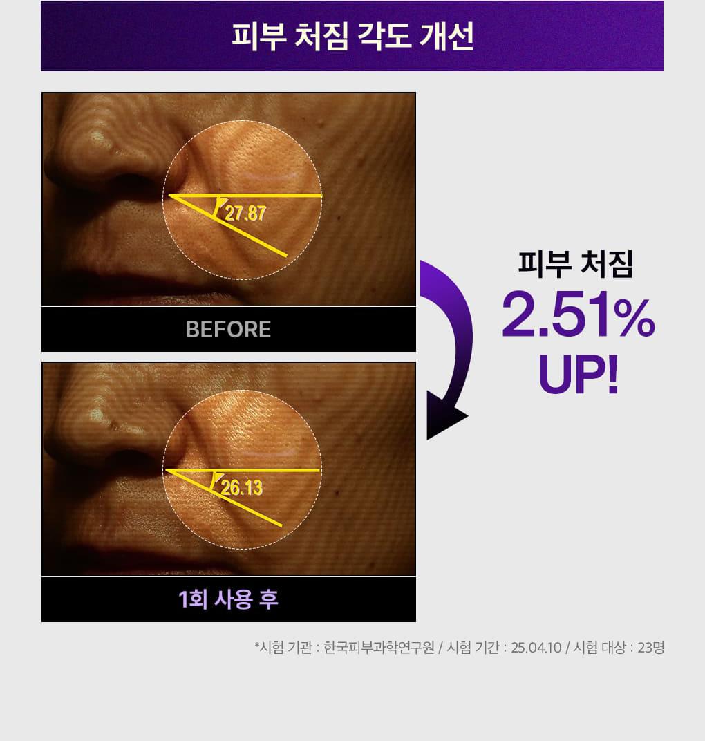 [Jangdoyeon PICK] Mediheal PDRN 毛孔紧致弹力精华 40+40ml 双重企划装 source detail 13