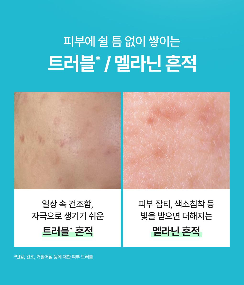 [紧贴精华面膜/4片] Mediheal 包装精华面膜 6Jong source detail 9