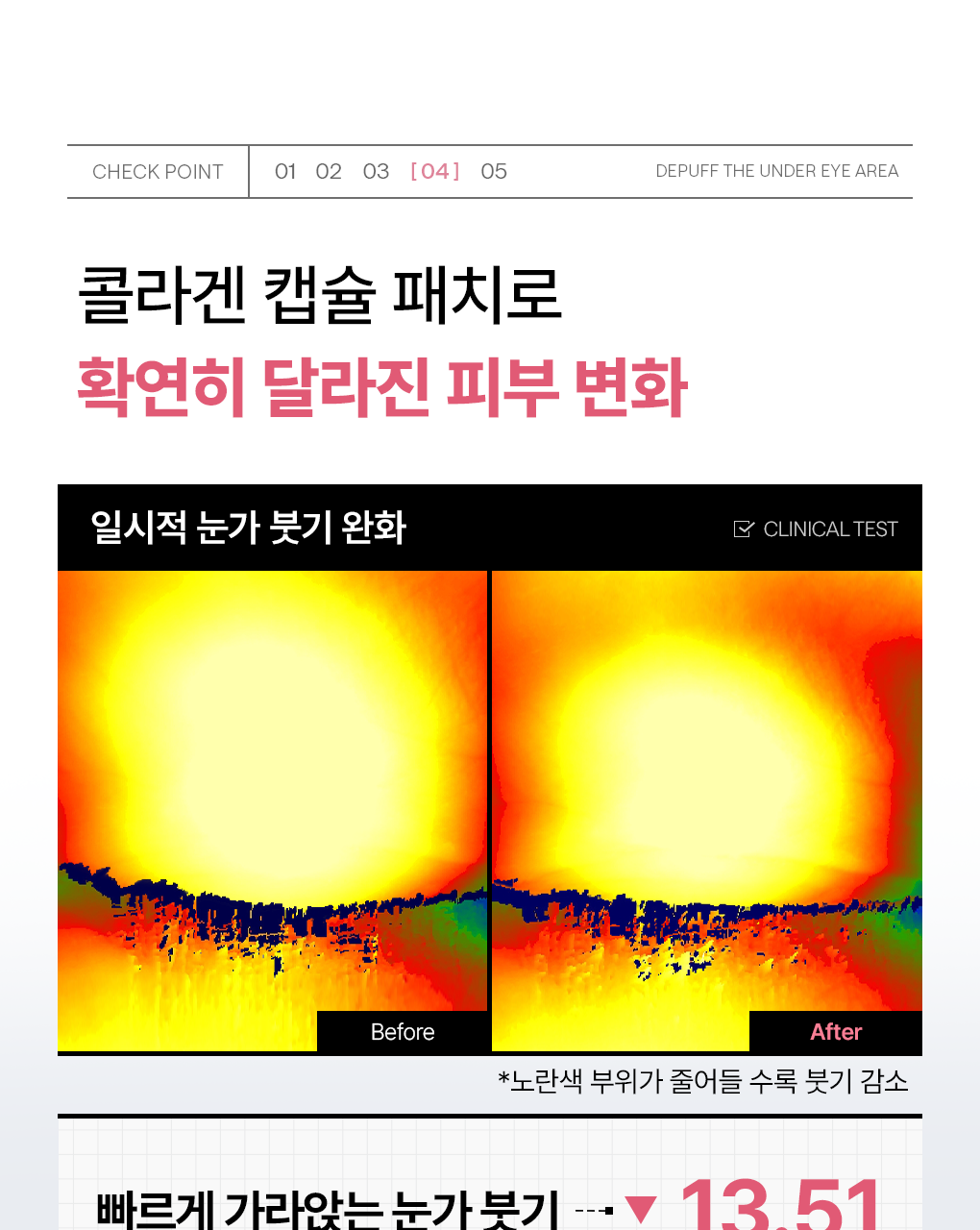 메디힐 콜라겐 캡슐 패치 비타 레티놀 11