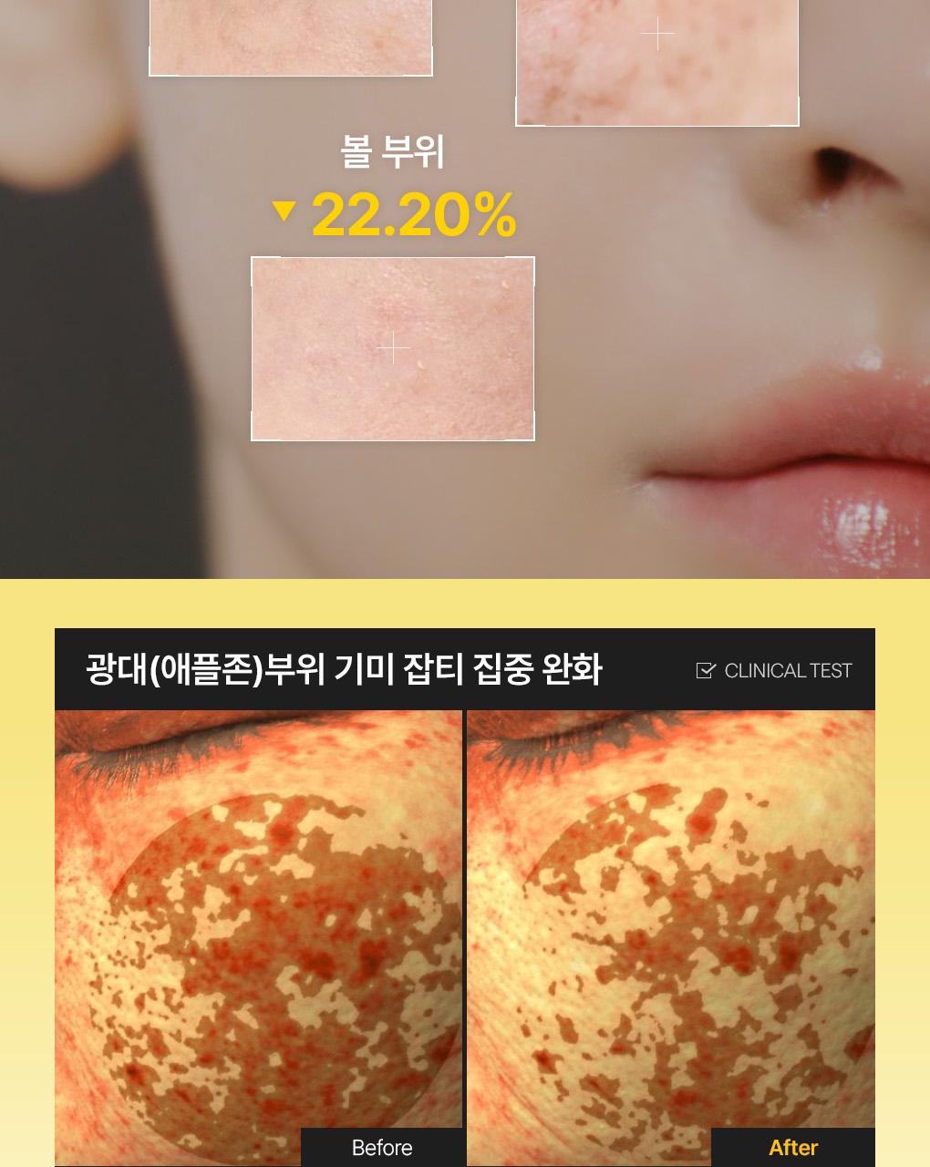 Mediheal 胶原蛋白 胶囊贴片 60+60片 双重企划装 2Jong (视黄醇/维生素C) source detail 26