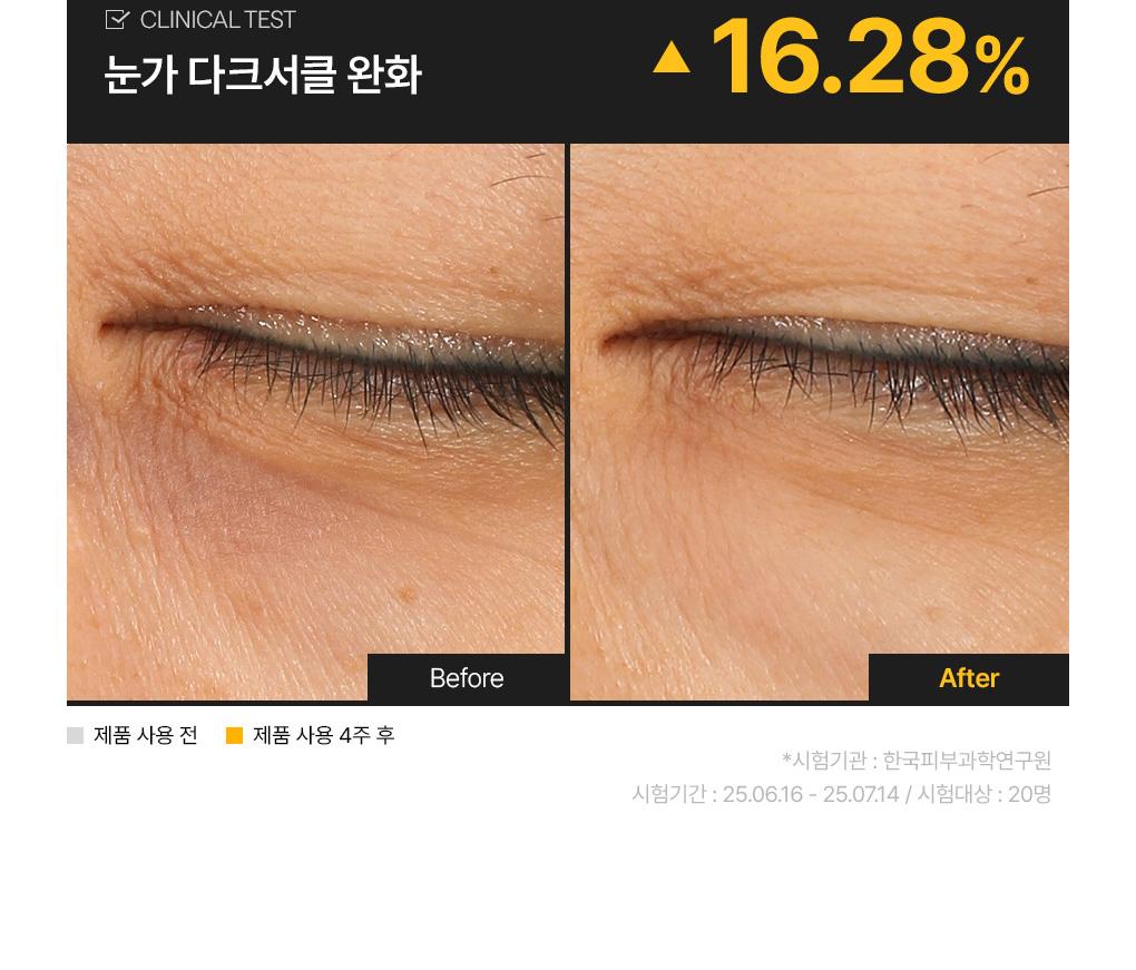 Mediheal 胶原蛋白 胶囊贴片 60+60片 双重企划装 2Jong (视黄醇/维生素C) source detail 23