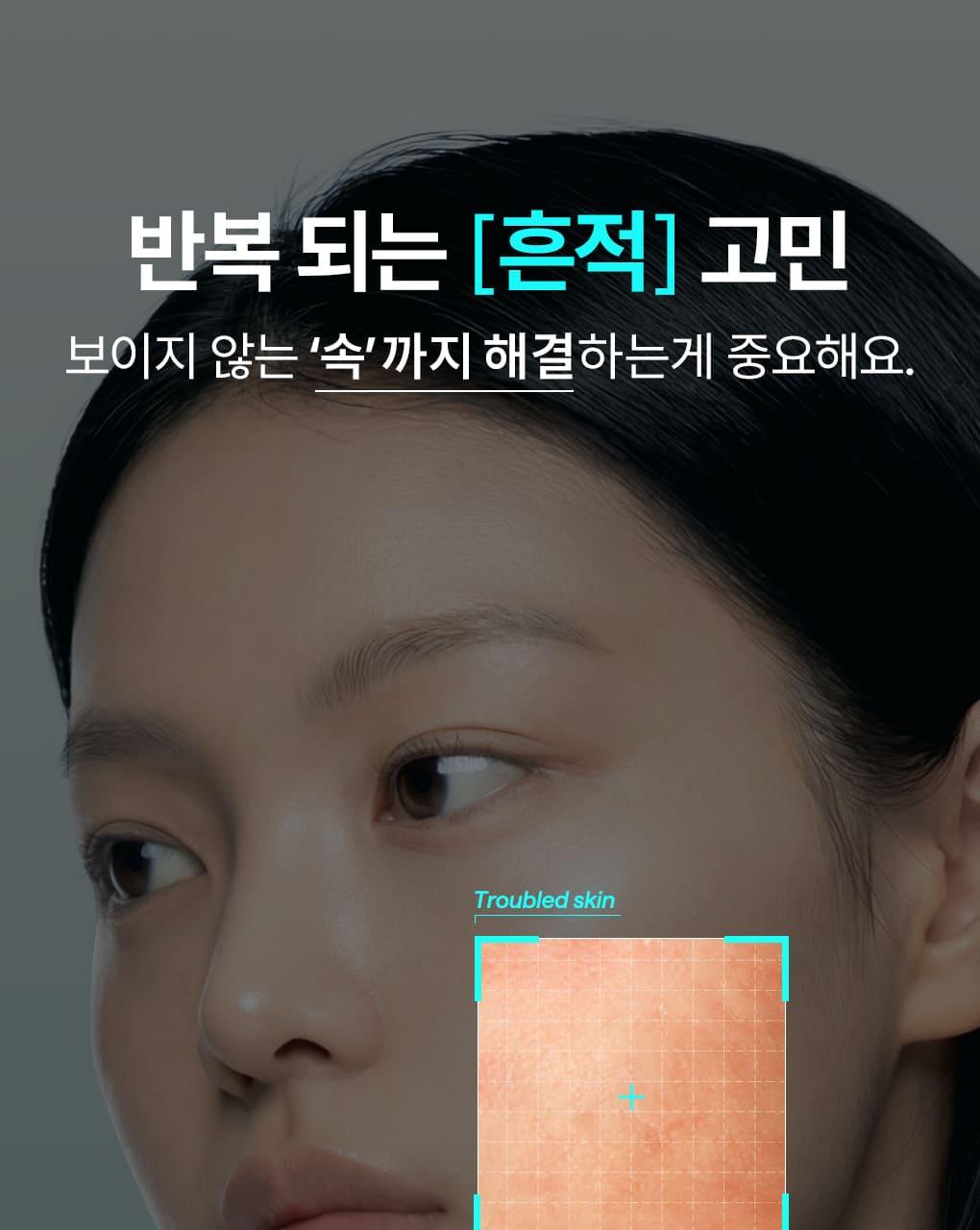 [补水痕迹修护面霜] Mediheal 积雪草苷 痘痕修护舒缓修复面霜 50ml source detail 4