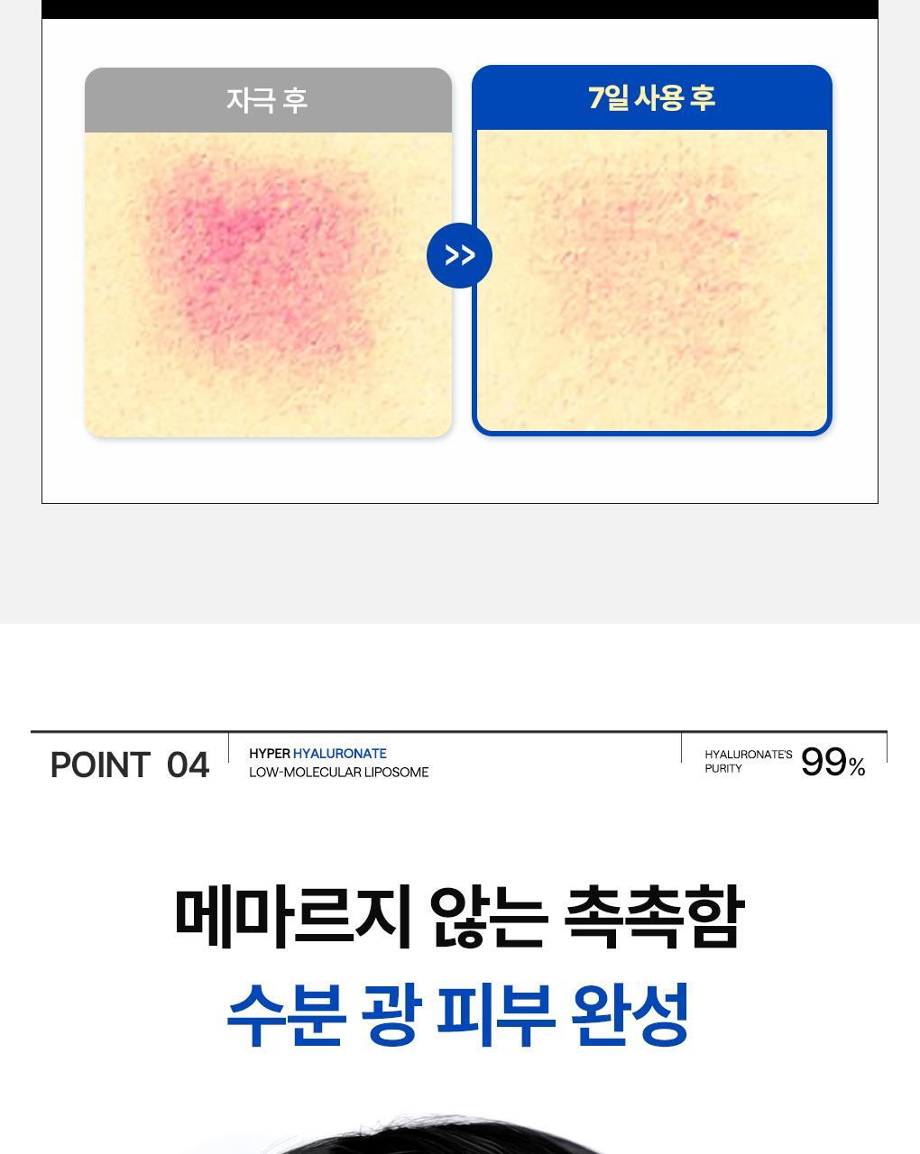 메디힐 하이퍼 겔 히알루론산 마스크 3