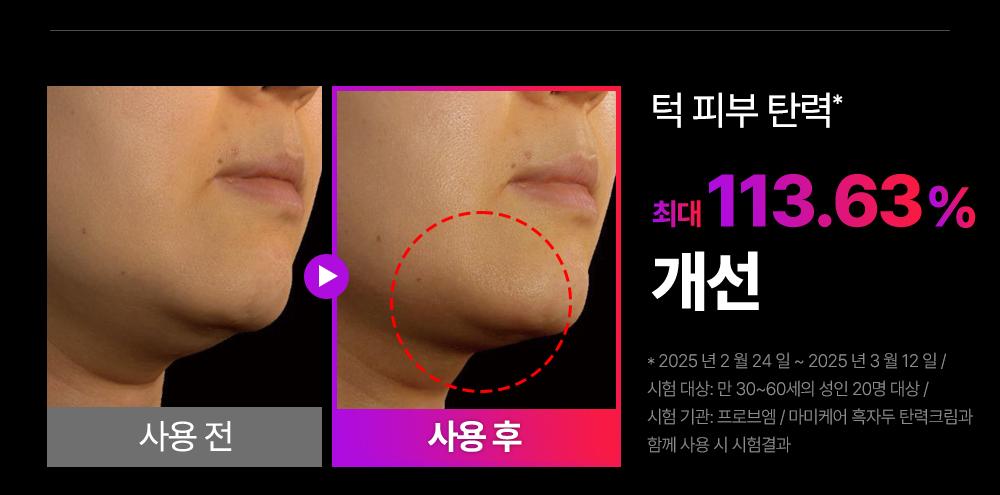 [DiBYSeu] Mommycare Beuissera/Pentapeu青柠 Taek 1 source detail 26