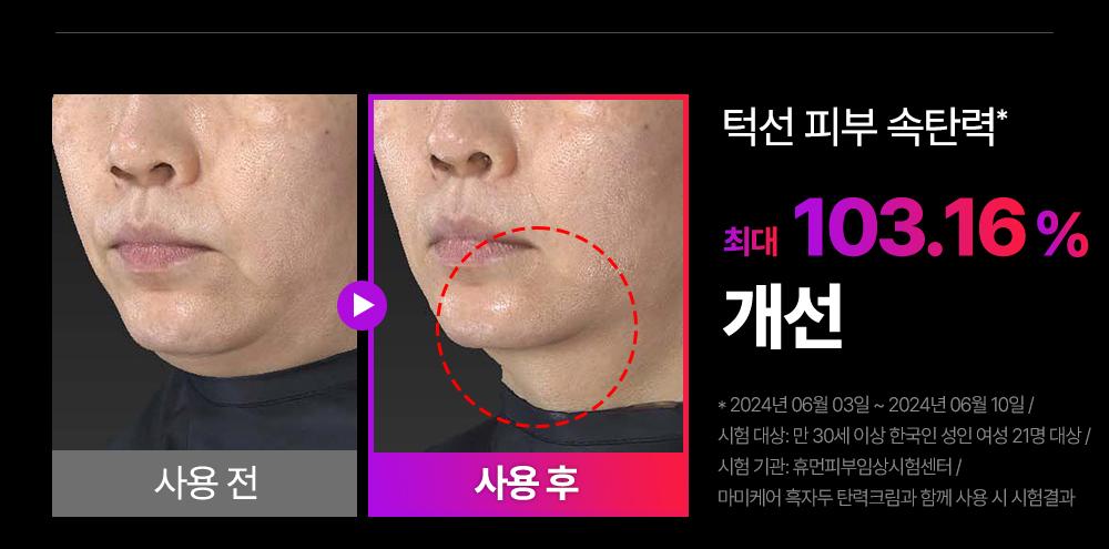 [DiBYSeu] Mommycare Beuissera/Pentapeu青柠 Taek 1 source detail 27