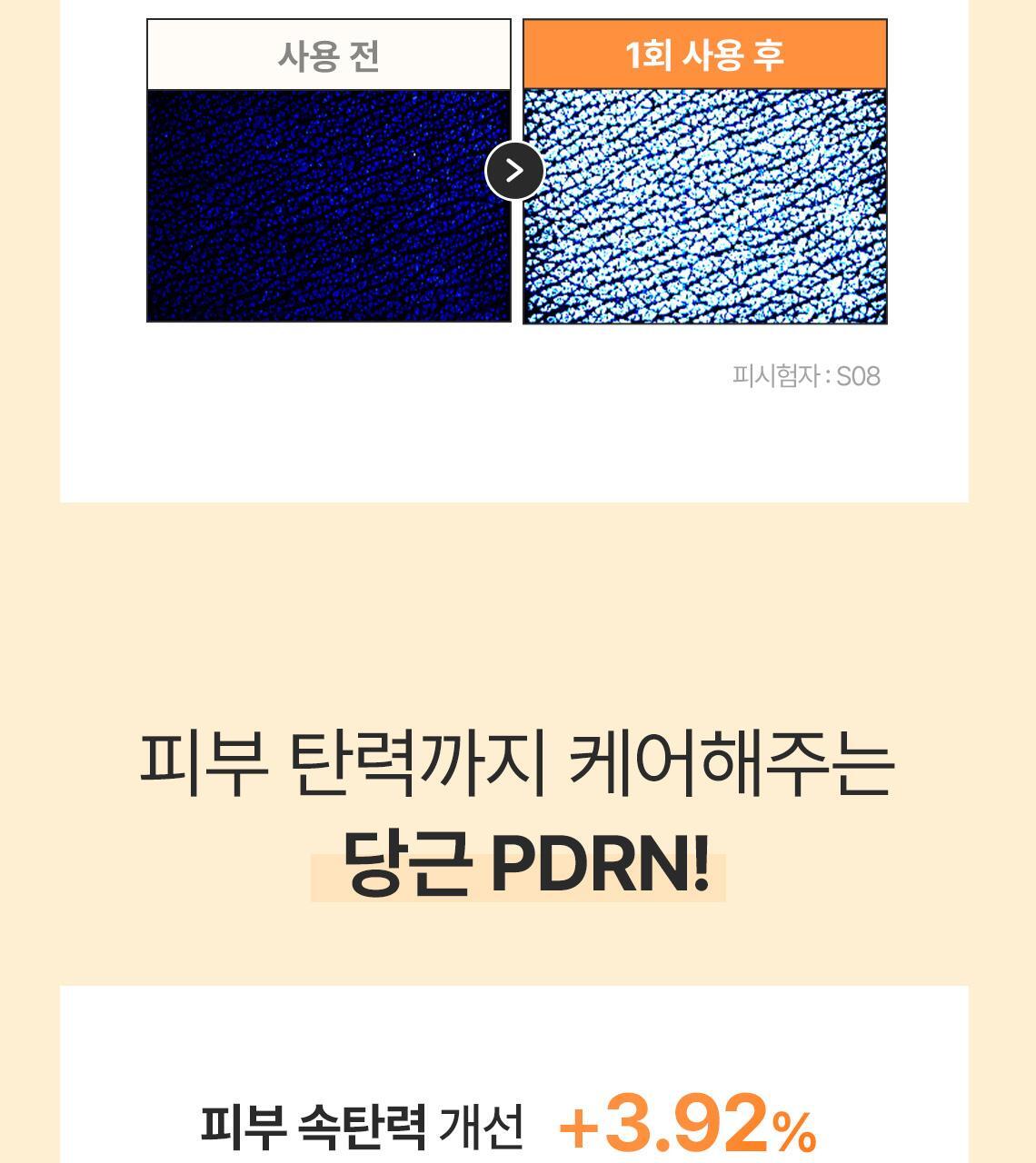 캐롯pdrn패드07
