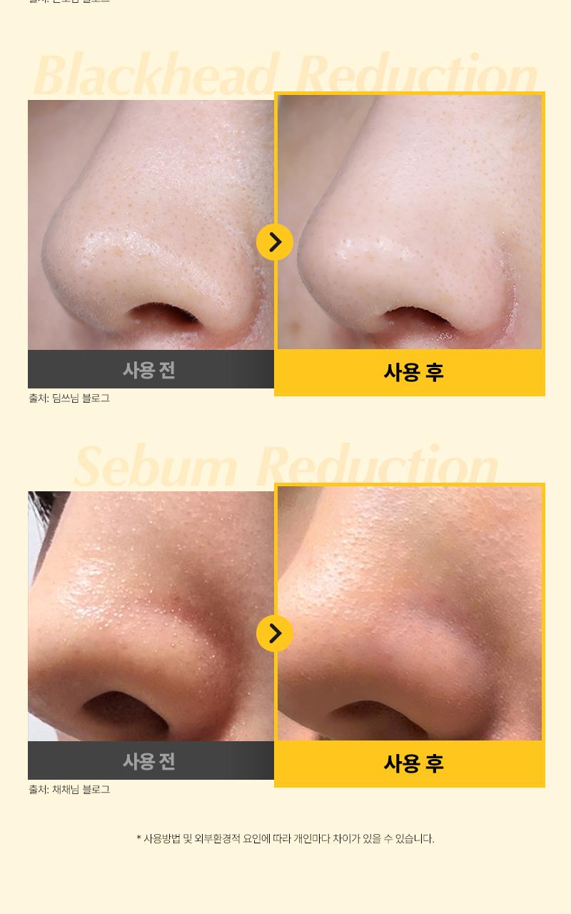 [한정수량][최다구성] 한스킨 클렌징오일&블랙헤드 PHA 200ml 더블더블기획 (+30ml*2) source detail 18