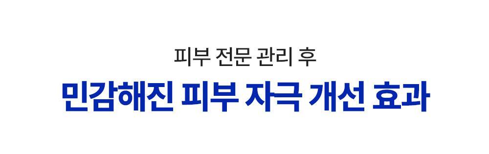 피부 전문 관리 후 민감해진 피부 자극 개선 효과