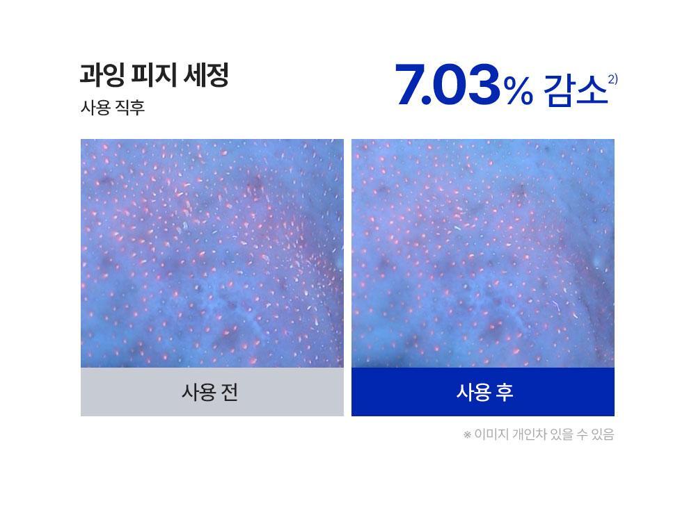 과잉 피지 세정 7.03%25 감소