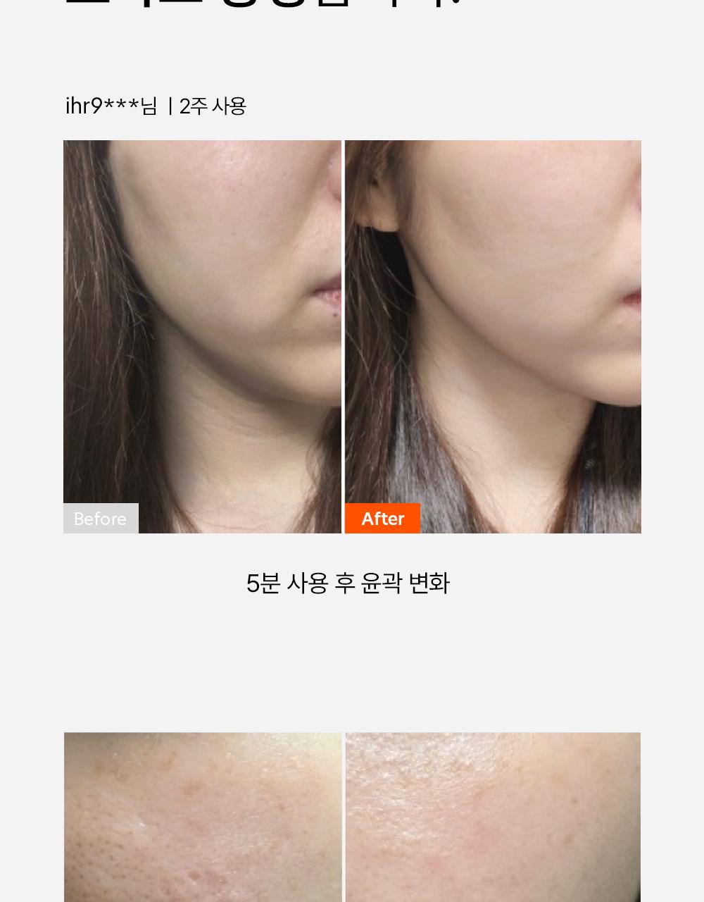 Dr.Tangler Gojupa Byuti DiBYSeu (弹力/补水/丰盈/毛孔片Seon) source detail 11