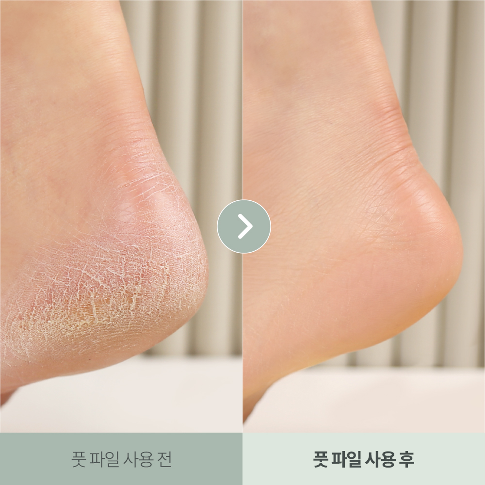 https://image.oliveyoung.co.kr/cfimages/cf-goods/uploads/images/thumbnails/10/0000/0015/A00000015989511ko.jpg?l=ko