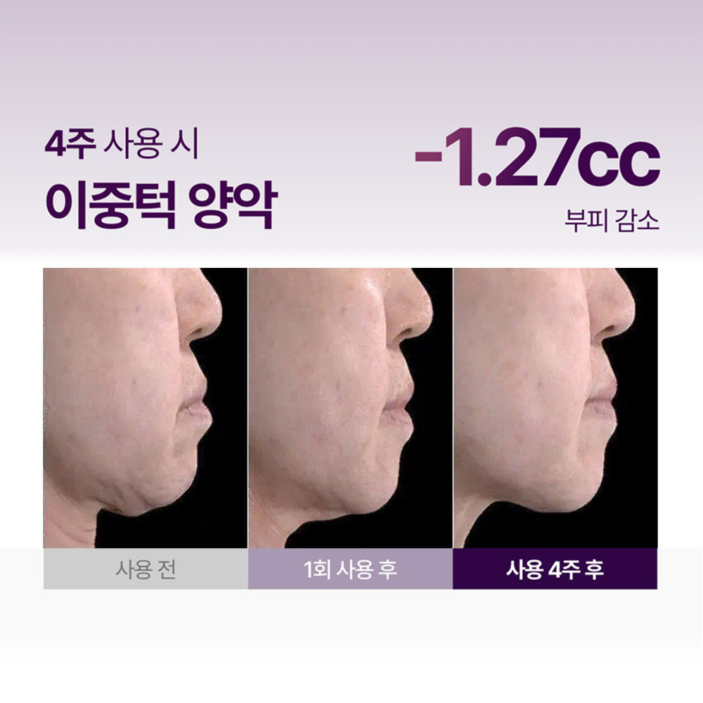 https://image.oliveyoung.co.kr/cfimages/cf-goods/uploads/images/thumbnails/10/0000/0022/A00000022383650ko.jpg?l=ko
