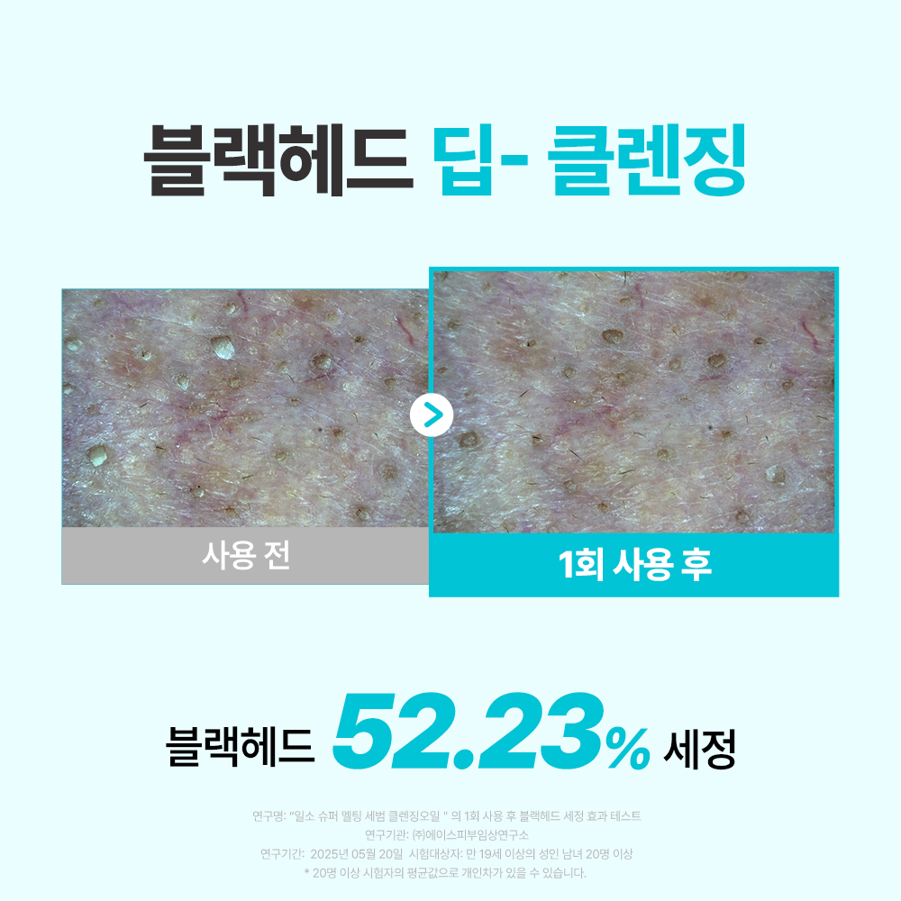https://image.oliveyoung.co.kr/cfimages/cf-goods/uploads/images/thumbnails/10/0000/0025/A00000025232004ko.jpg?l=ko
