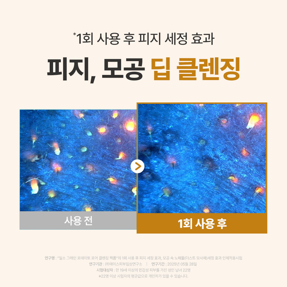 https://image.oliveyoung.co.kr/cfimages/cf-goods/uploads/images/thumbnails/10/0000/0025/A00000025232111ko.jpg?l=ko