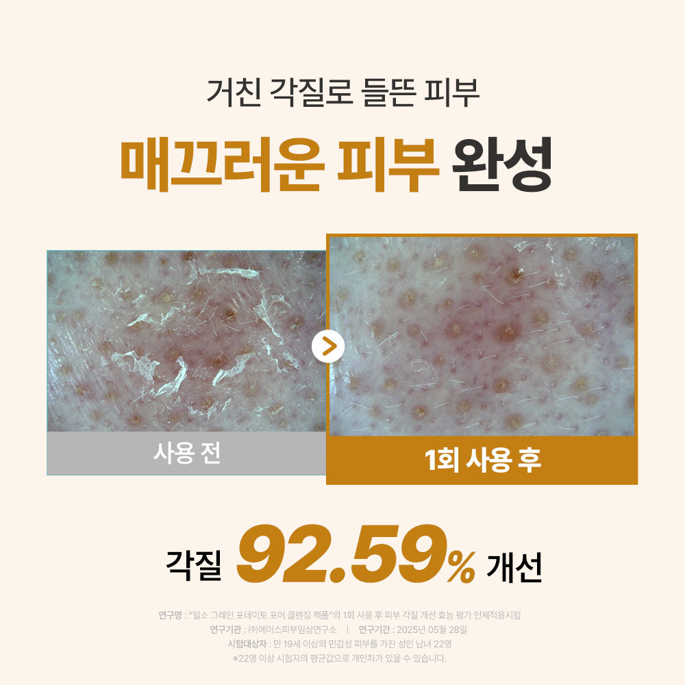 https://image.oliveyoung.co.kr/cfimages/cf-goods/uploads/images/thumbnails/10/0000/0025/A00000025232112ko.jpg?l=ko