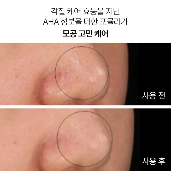 https://image.oliveyoung.co.kr/cfimages/cf-goods/uploads/images/thumbnails/10/0000/0025/A00000025297903ko.jpg?l=ko