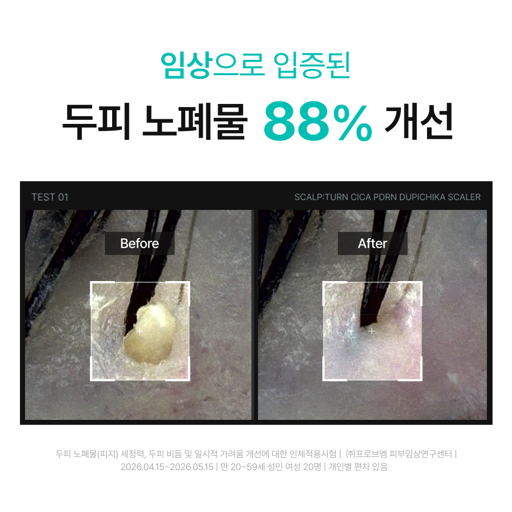 https://image.oliveyoung.co.kr/cfimages/cf-goods/uploads/images/thumbnails/10/0000/0025/A00000025969108ko.jpg?l=ko