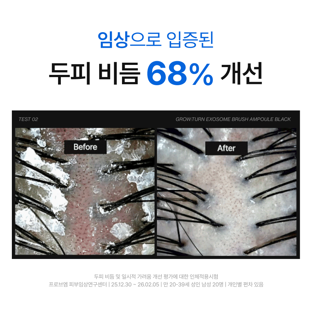 https://image.oliveyoung.co.kr/cfimages/cf-goods/uploads/images/thumbnails/10/0000/0026/A00000026136405ko.jpg?l=ko