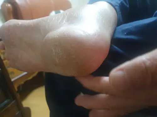 买家评价图片