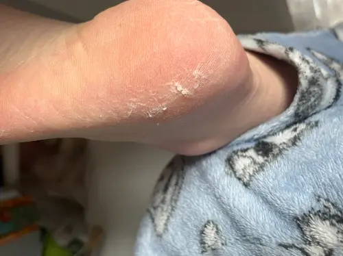 买家评价图片